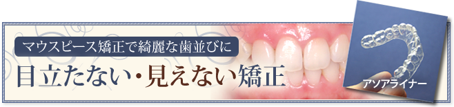 目立たない・見えない矯正 マウスピース矯正で綺麗な歯並びに